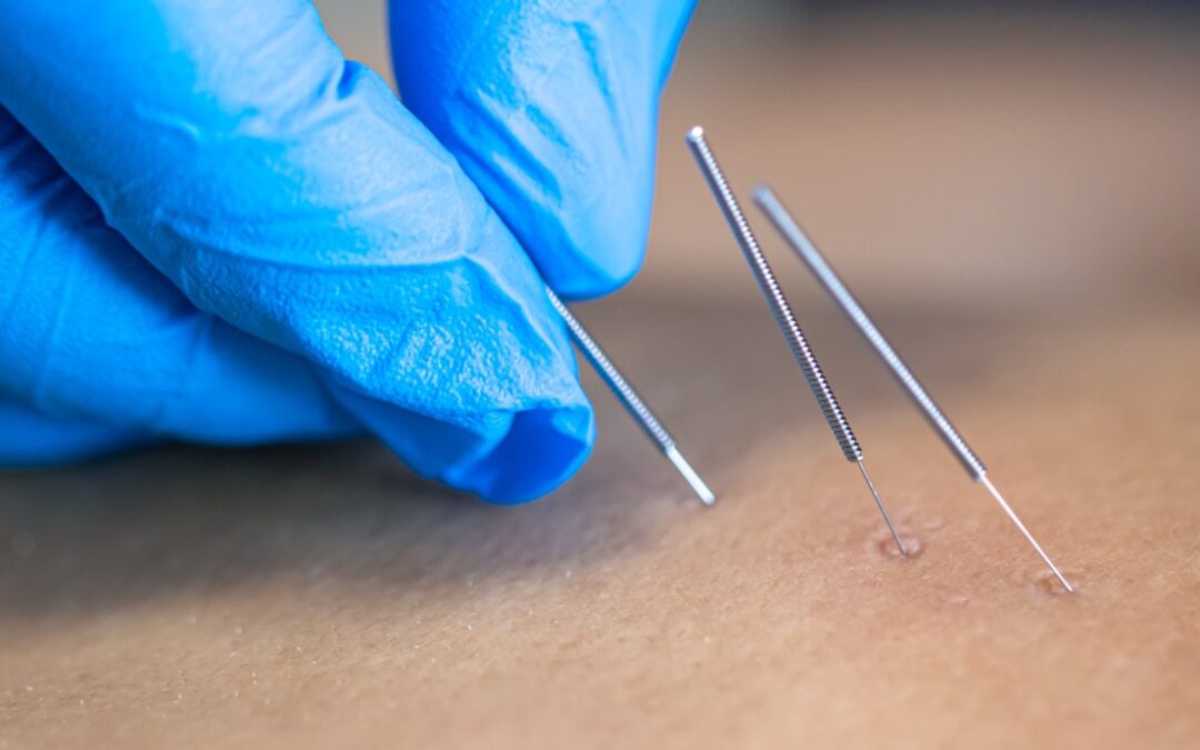 STRES, EMOCIJE I BOL – povezanost koju ne smijemo zanemariti